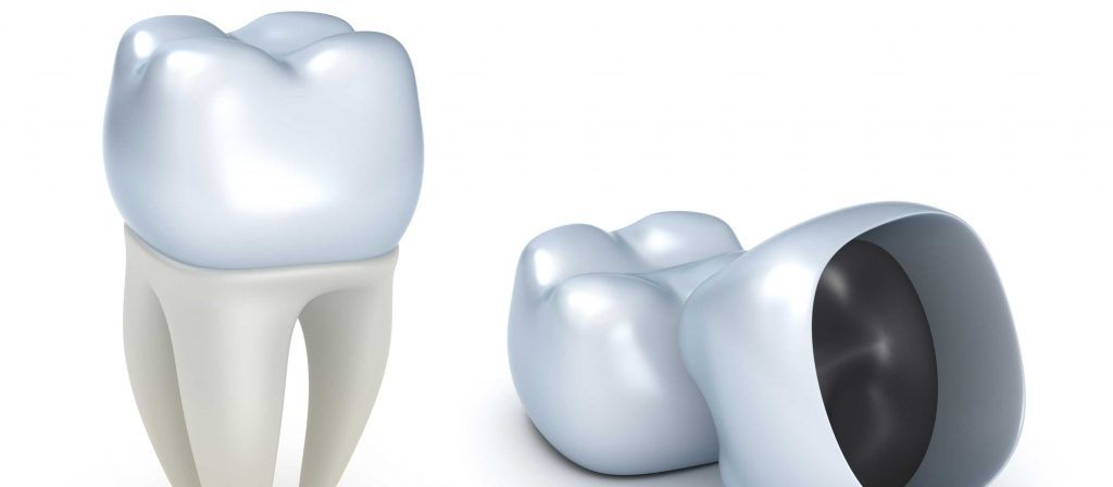 dental crowns